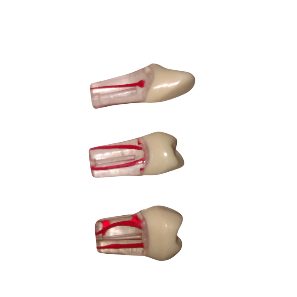 Original Endodontic Teeth